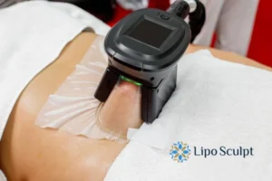 Cryolipolysis Helping You Getting that Perfect Summer Body 3 Cryolipolysis Bridgend can give you the best summer body - contact us today!